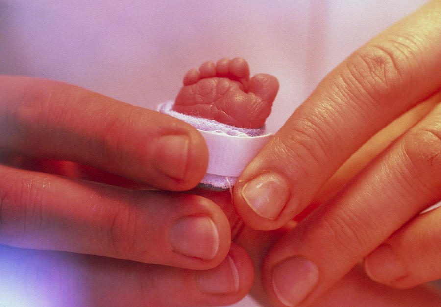 Toes Photograph - Hands Holding The Foot Of A Premature Baby by Mauro Fermariello
