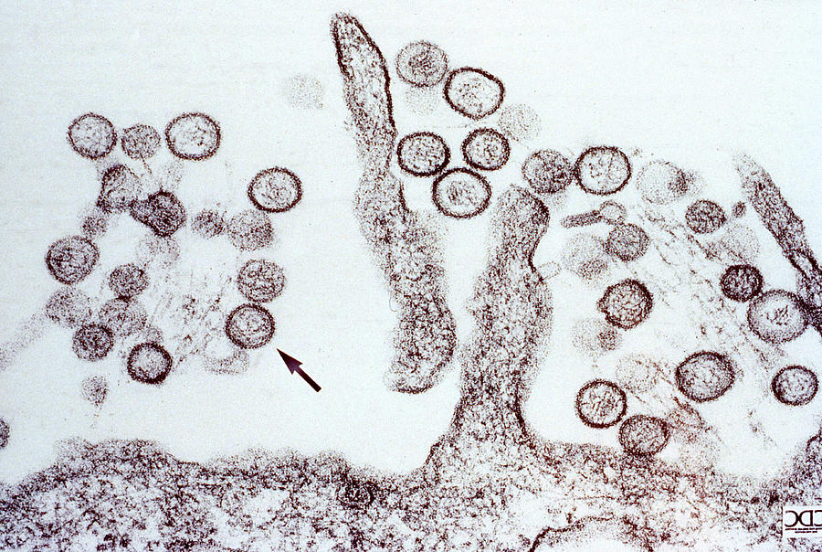 Hanta Virus Tem Photograph by Science Source
