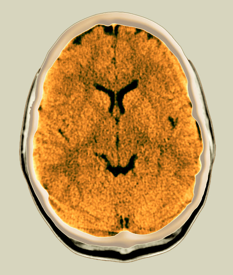 Healthy Brain Ct Scan Photograph By Du Cane Medical Imaging Ltd