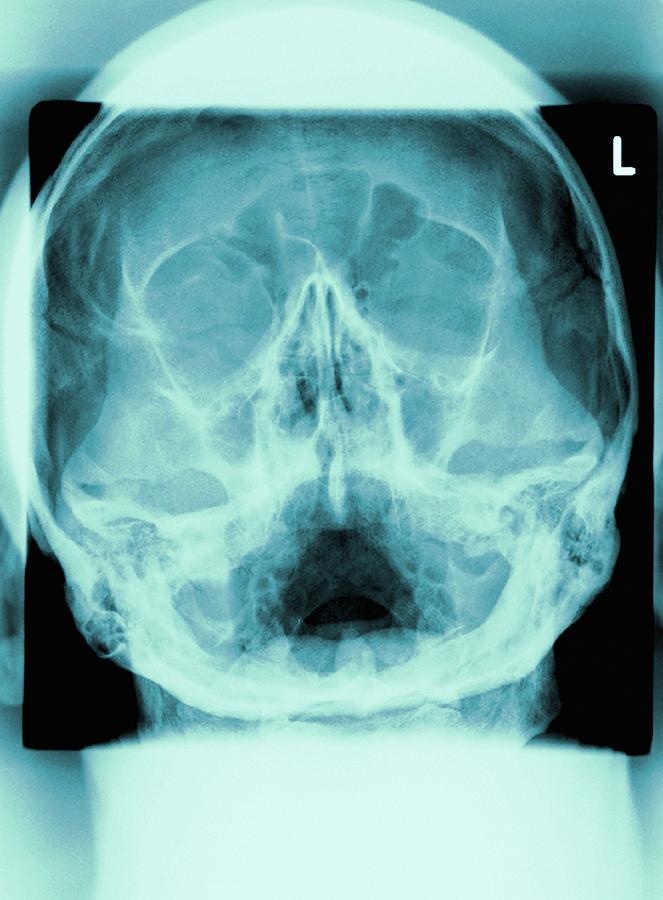 Skeleton Photograph - Healthy Skull, X-ray by Miriam Maslo