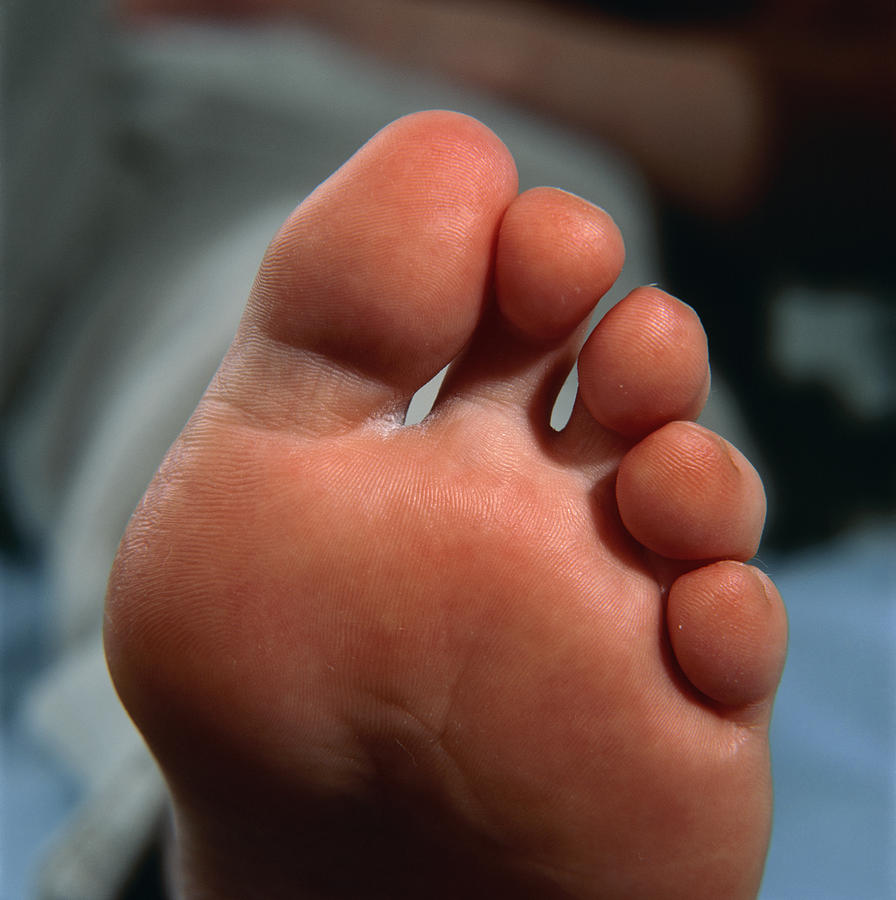 Healthy Toes And Sole Of A Woman's Foot by Damien Lovegrove