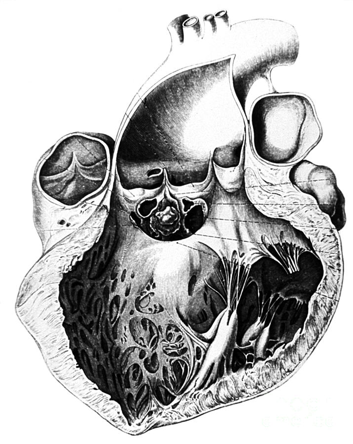 Heart Anatomy, Carl Von Rokitansky, 1875 by Science Source | Fine Art ...