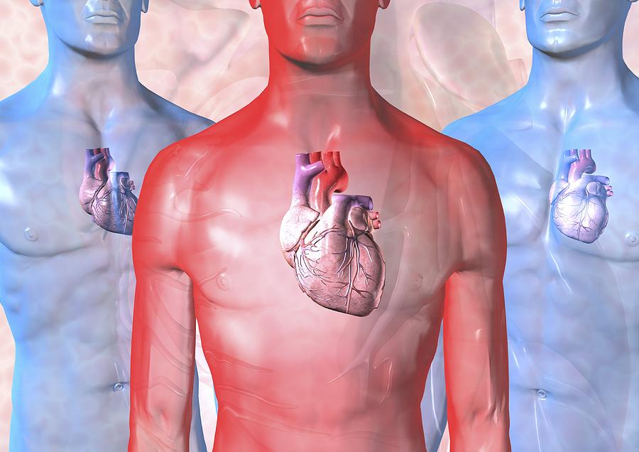 Left Ventricular Hypertroph Photograph - Heart Failure, Artwork by David Mack