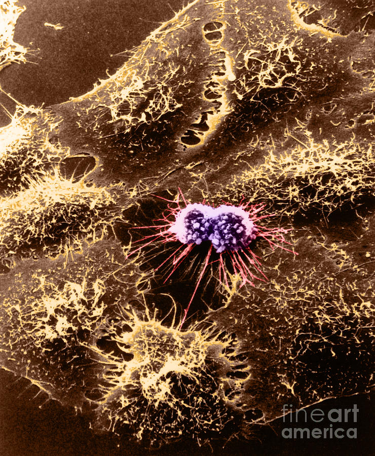 Hela Cells With Adenovirus Photograph by Science Source