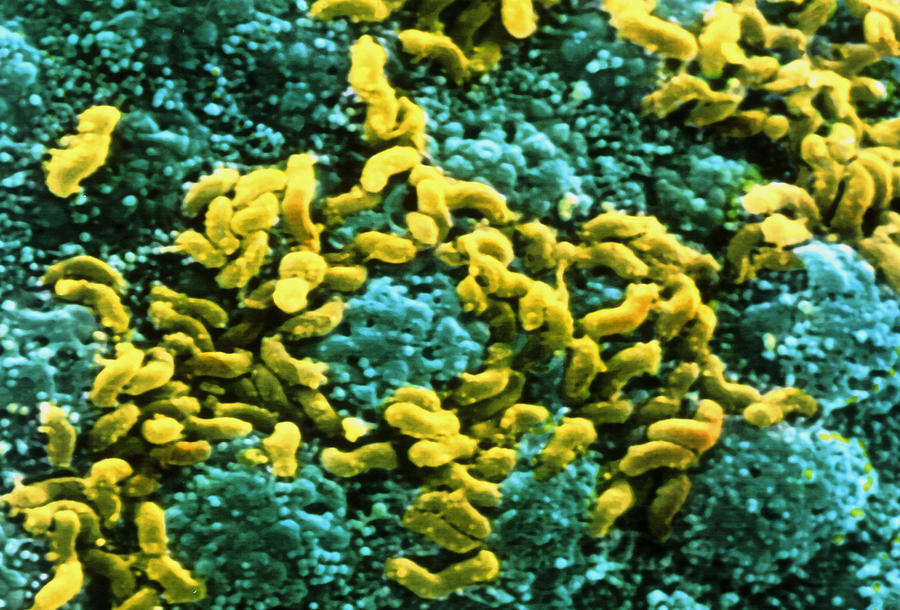 Helicobacter Pylori Photograph - Helicobacter Pylori Bacteria On Stomach by Prof. P. Mottadept. Of Anatomyuniversity \la Sapienza\, Rome