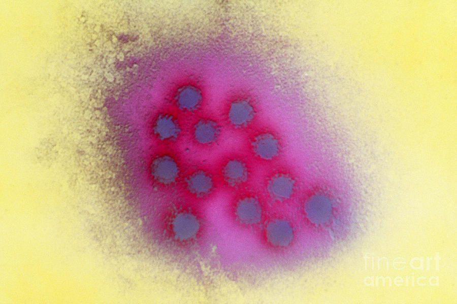 Hepatitis A Virus Tem Photograph by Science Source
