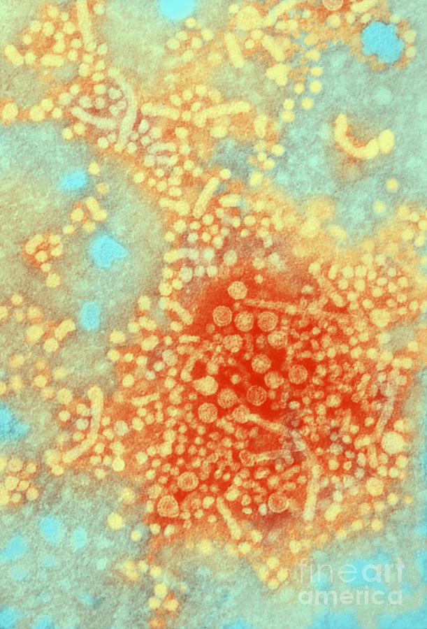 Hepatitis B Tem Photograph by Science Source