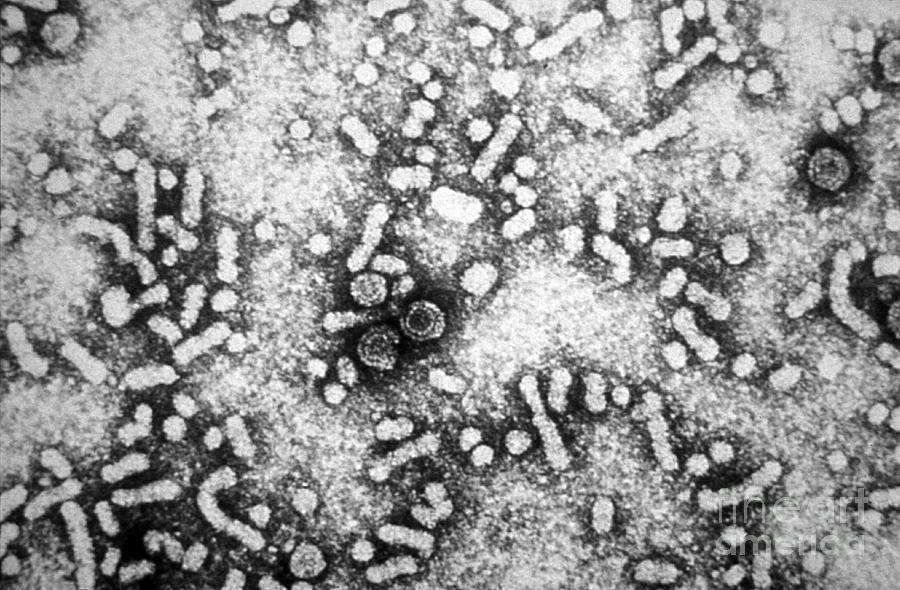 Hepatitis-b Virus, Em Photograph by Science Source