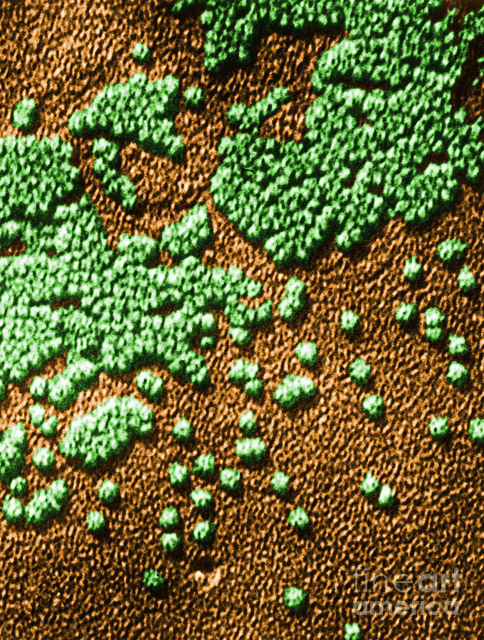 Hepatitis Virus Photograph by Omikron