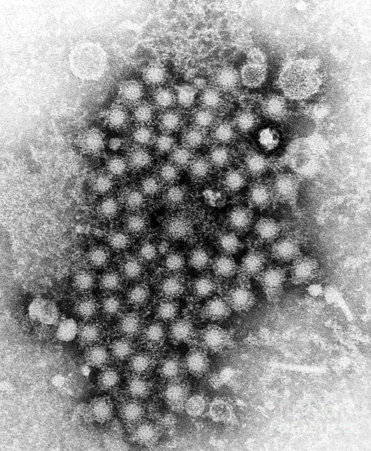 Hepatitis Virus, Unknown Strain, Tem Photograph by Science Source
