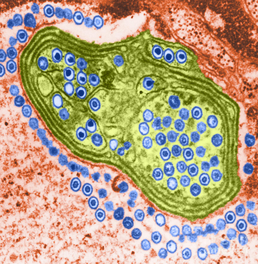 Herpes Simplex Virus, Tem Photograph by Science Source