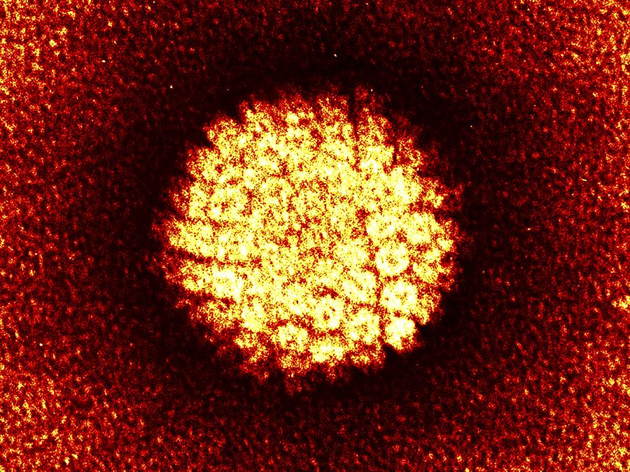 Herpes Virus Particle Tem Photograph By Pasieka