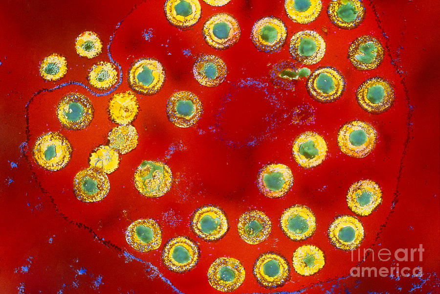 Herpes Virus Photograph by Science Source