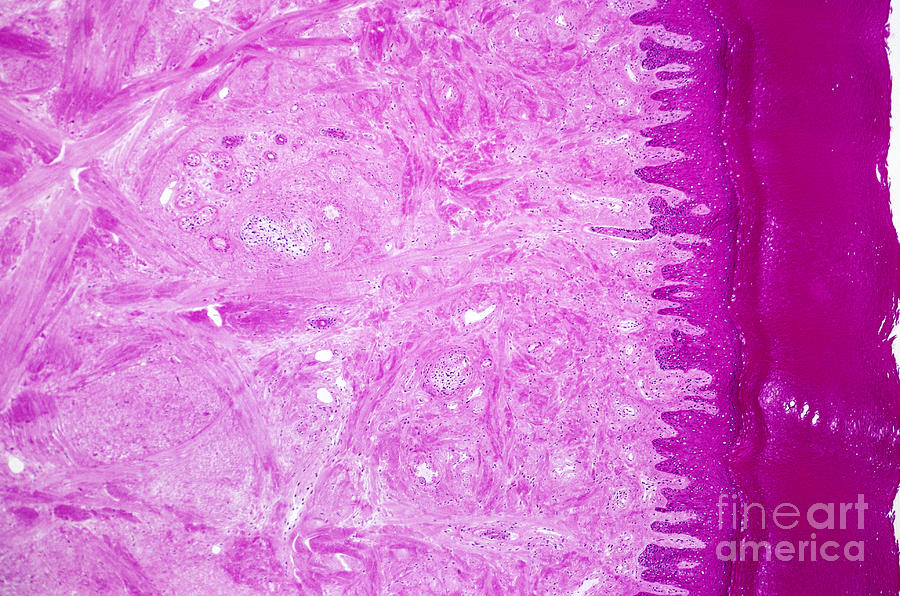 Histology Of Skin Of Palm Photograph by M. I. Walker