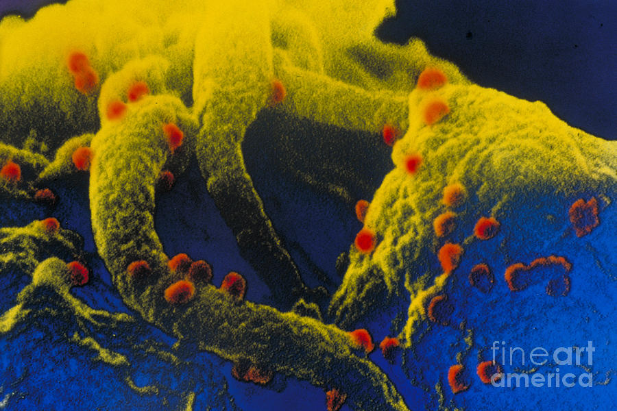 Hiv Budding From A Lymphocyte Photograph by Science Source