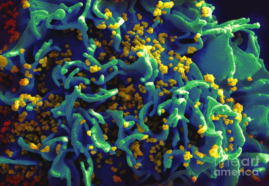 Hiv-infected H9 T Cell, Sem Photograph by Science Source