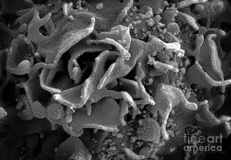 Hiv-infected T Cell, Sem Photograph by Science Source
