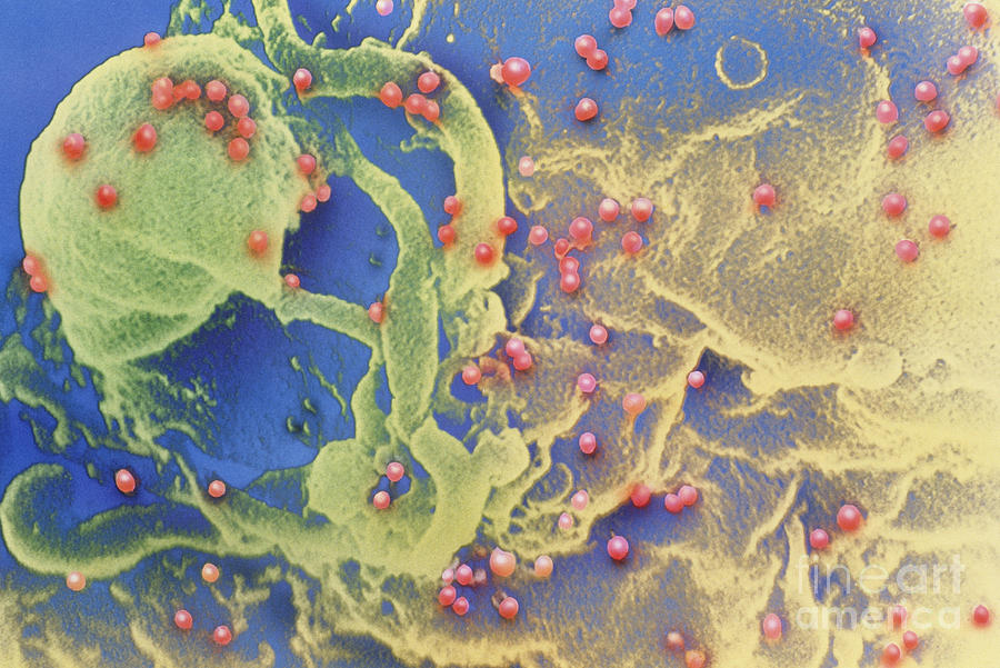 Hiv Viruses Photograph by Science Source