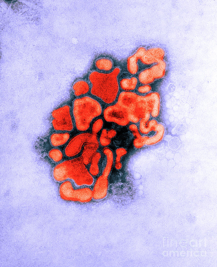 Hsw1n1 Swine Flu, Tem Photograph by Science Source