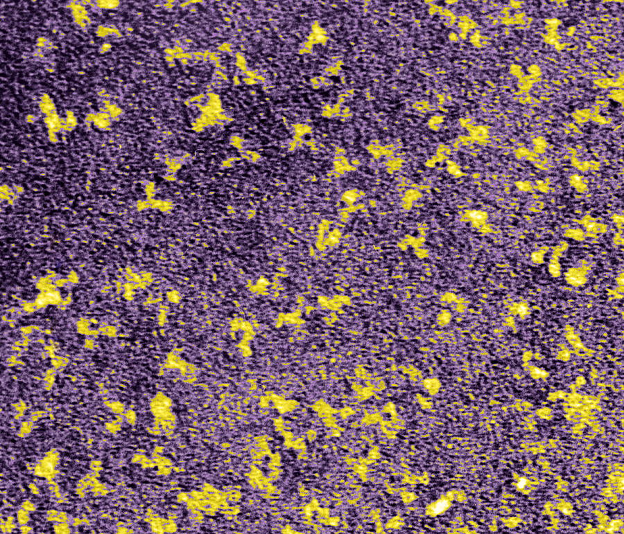 Human Antibodies, Tem Photograph by Dr Klaus Boller - Pixels