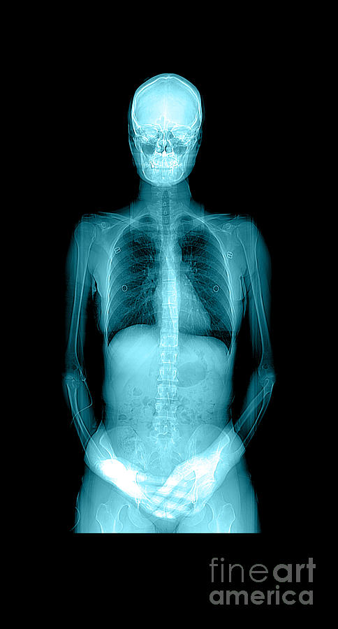 Human Body X-ray And Ct Photograph by Medical Body Scans
