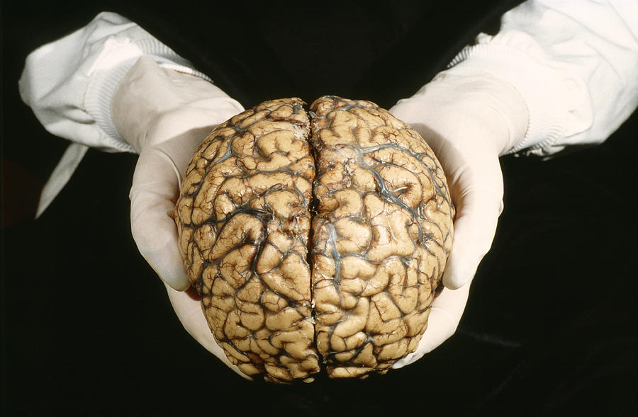 Brain Anatomy Photograph - Human Brain by Geoff Tompkinson