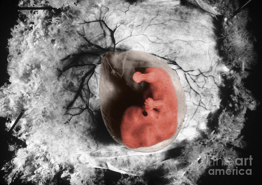 Human Embryo Photograph by Omikron