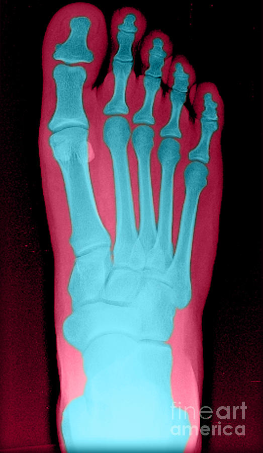 Human Foot Photograph by Medical Body Scans