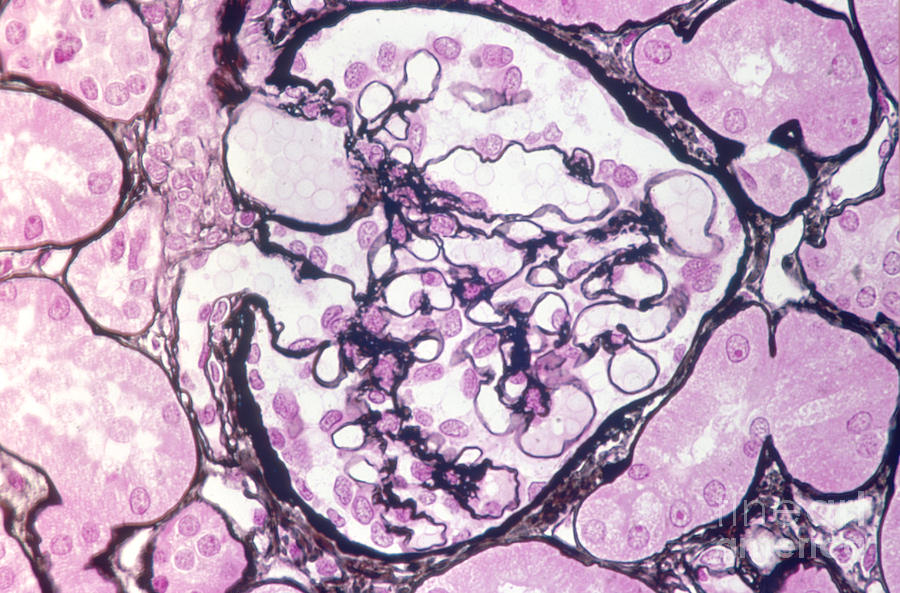 Histology Photograph - Human Kidney Cells by M. I. Walker