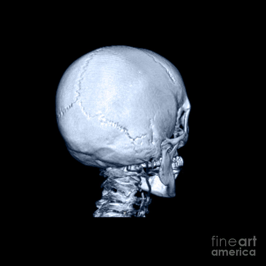 Skull Photograph - Human Skull by Medical Body Scans