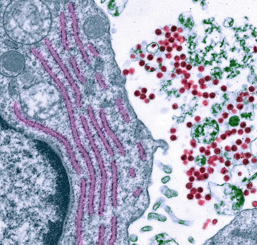 Virus Photograph - Hybridoma Cell, Tem by Steve Gschmeissner
