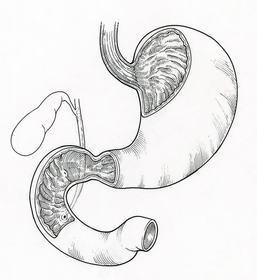 Anatomy Photograph - Illustration Of Stomach And Duodenum by Science Source