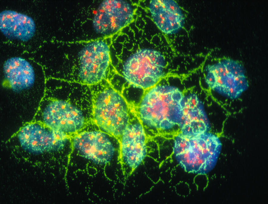 Immunofluorescent Lm Of Lung Cancer Cell Culture Photograph by Nancy ...