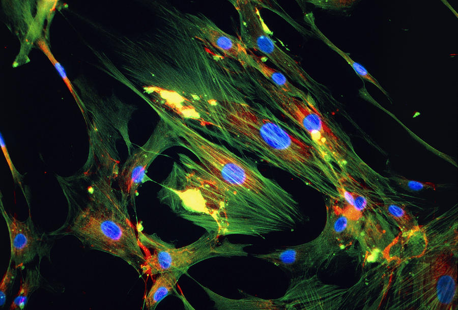 Immunofluorescent Lm Of Skin Fibroblast Cells Photograph by Science ...