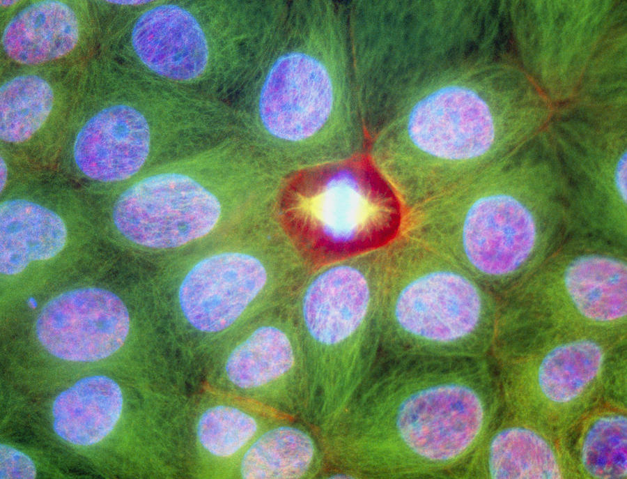 Images Photograph - Immunofluorescent Lm Of Squamous Carcinoma Cells by Nancy Kedersha