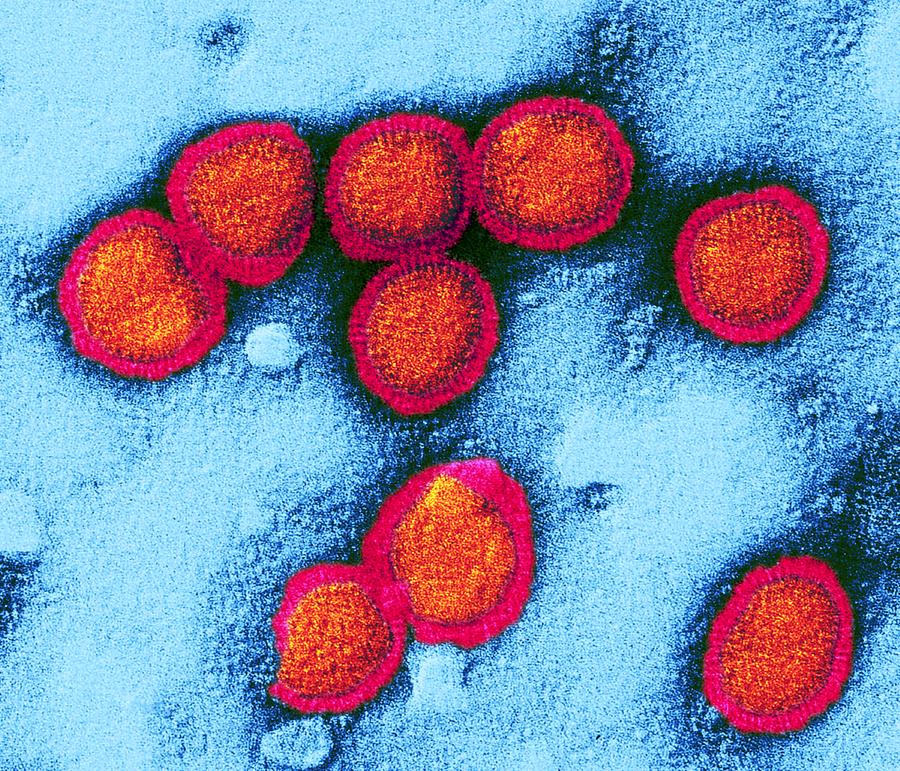 Influenzavirus B Photograph - Influenzavirus B, Tem by Dr Klaus Boller