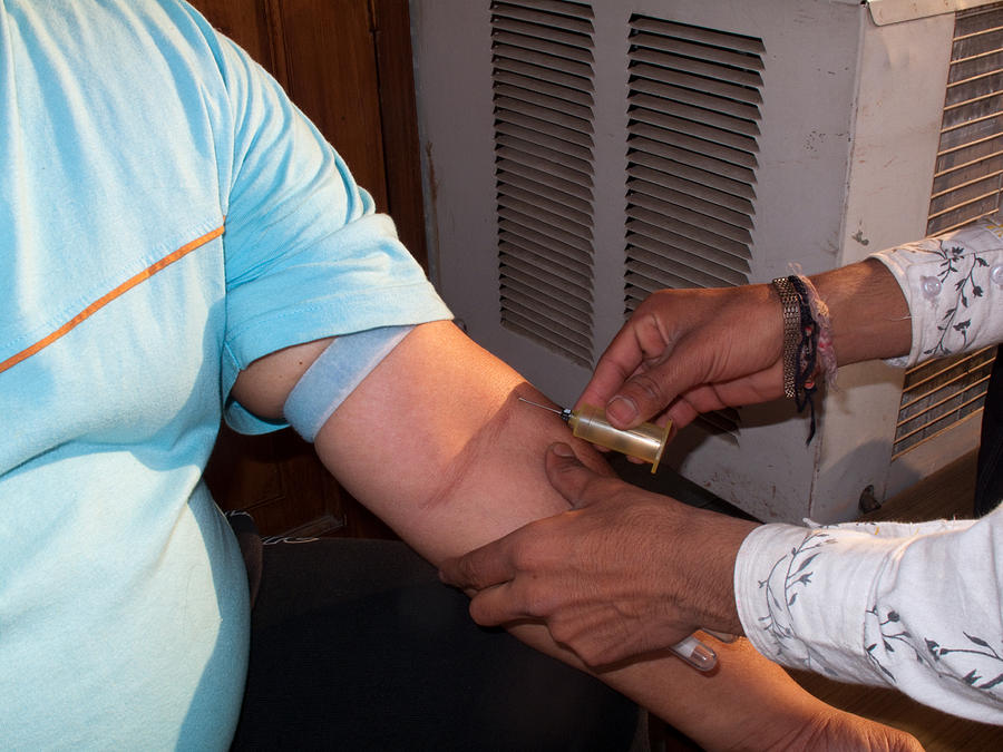 Inserting the first part of the blood test collection apparatus Photograph by Ashish Agarwal