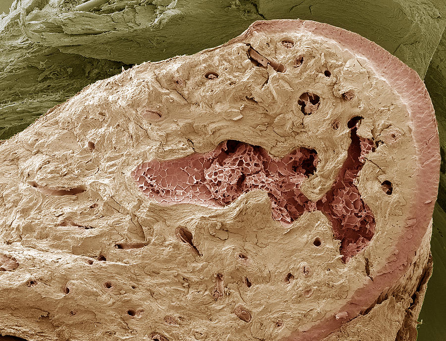 Bone Marrow Photograph - Interior Of A Bone, Sem by Steve Gschmeissner
