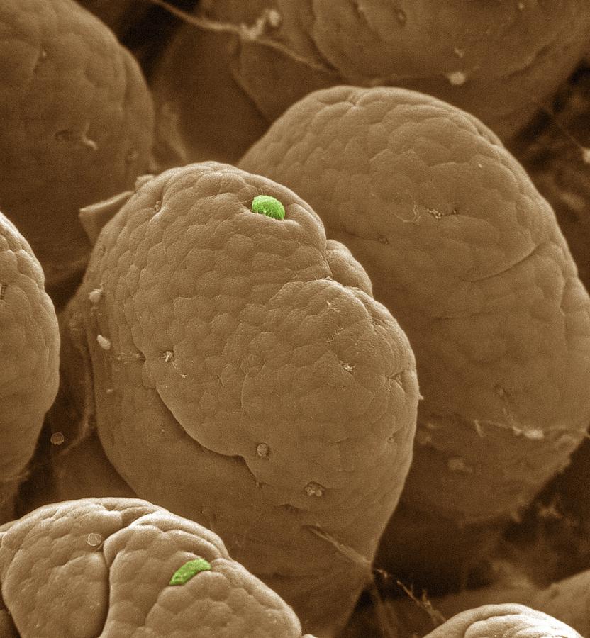 Intestinal Villus Photograph - Intestinal Villi Cell Loss, Sem by 