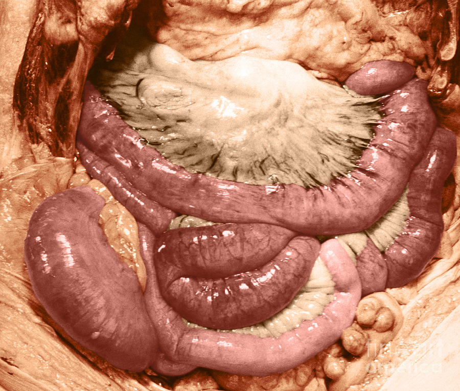 Intestines Photograph by Omikron