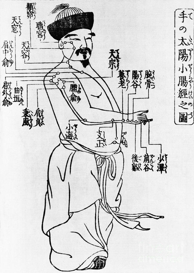 Japanese Illustration Of Acupuncture Photograph by Science Source