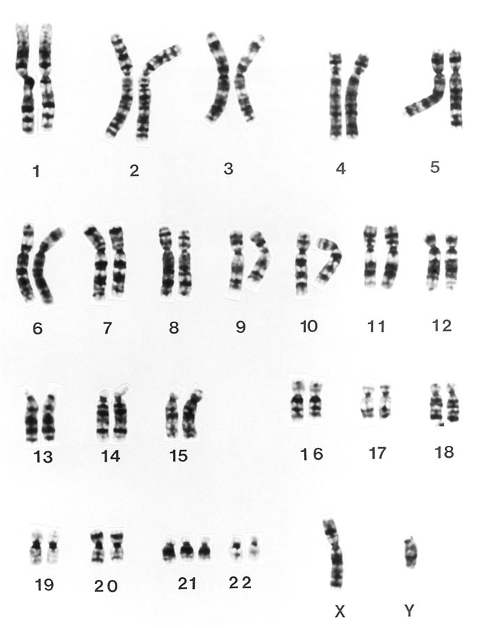 a karyotype shows chromosomes arranged by