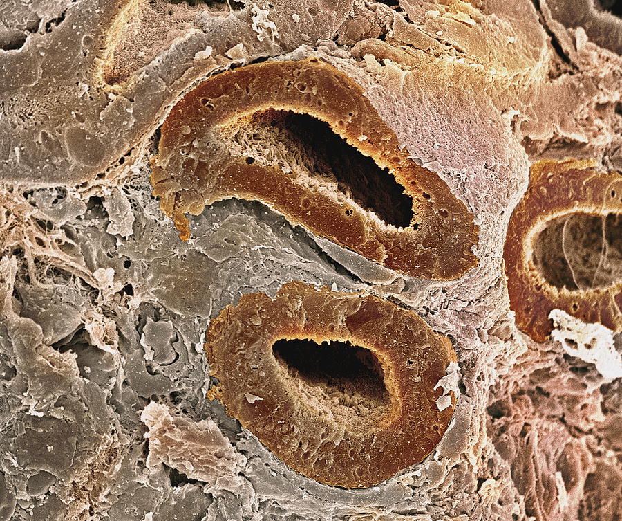 Proximal Convoluted Tubule Photograph - Kidney Tubules, Sem by Steve Gschmeissner