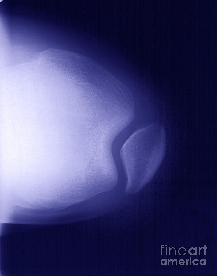 Skeleton Photograph - Knee by Ted Kinsman