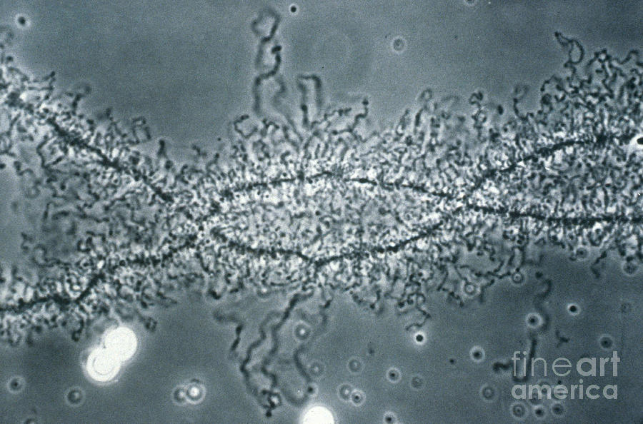 Dna Photograph - Lampbrush Chromosome by Omikron
