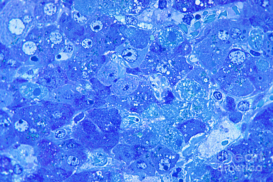 Hepatitis Photograph - Lassa Virus by Science Source