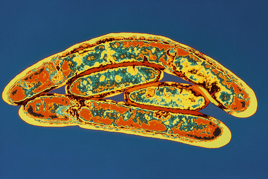 Legionella Bacteria Photograph By Dr Linda Stannard, Uct - Fine Art America