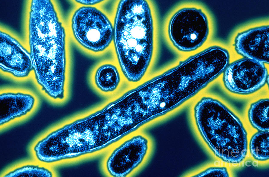 Legionella Bacteria Photograph by Science Source