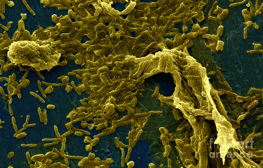 Legionella Pneumophila Sem Photograph by Science Source