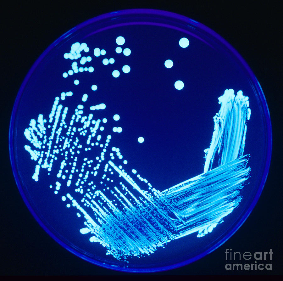 Legionella Sp. Cultured Photograph by Science Source